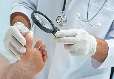 Hammertoe and Corns: Diagnosis and Treatment in Brooklyn