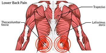 How do we treat spasmed low back muscles with manual therapy?