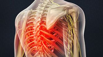 Electrical Nerve Stimulation (Chronic Pain Doctors) Brooklyn NYC