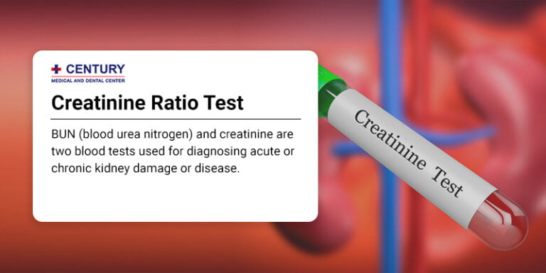 About Our Buncreatinine Ratio Test Century Medical And Dental Center 9578