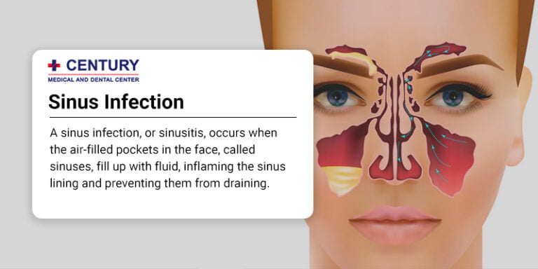 Are Sinus Infections Contagious Century Medical Dental Center   Are Sinus Infections Contagious 768x384 