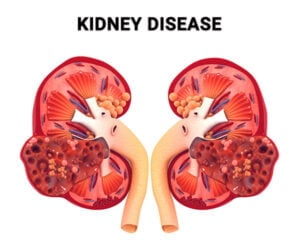 What Is Nephrology? - Century Medical & Dental Center