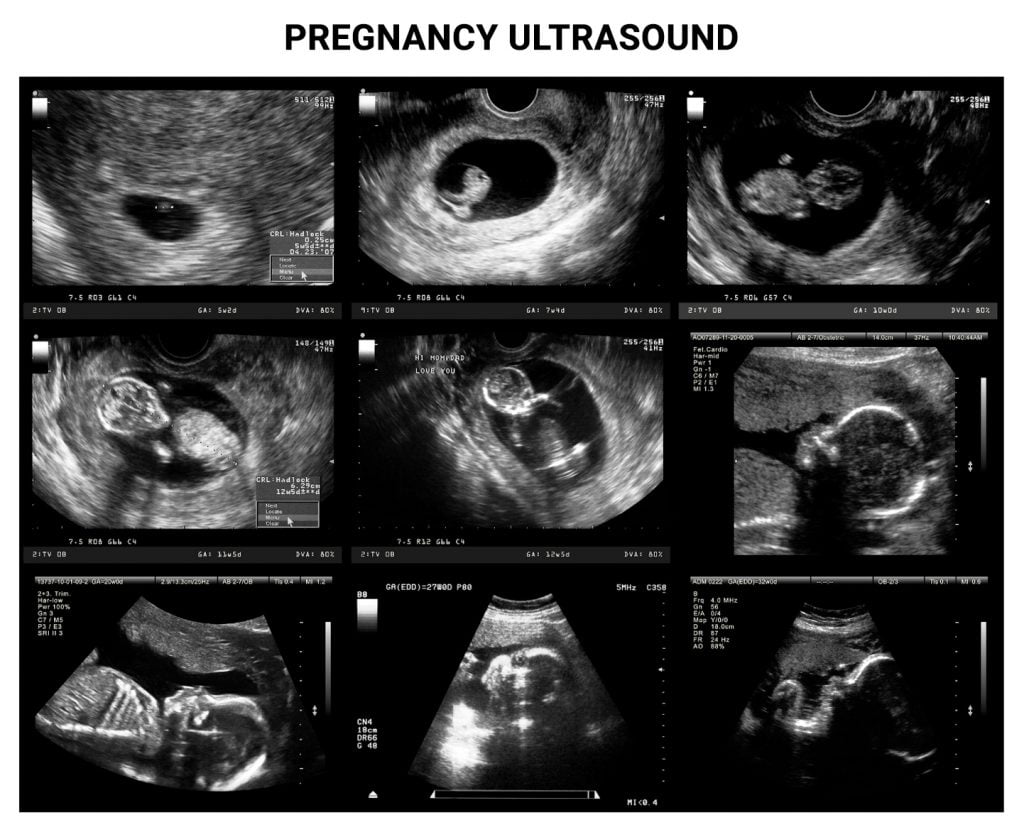 Ultrasounds During Pregnancy What You Need To Know Century Medical And Dental Center 