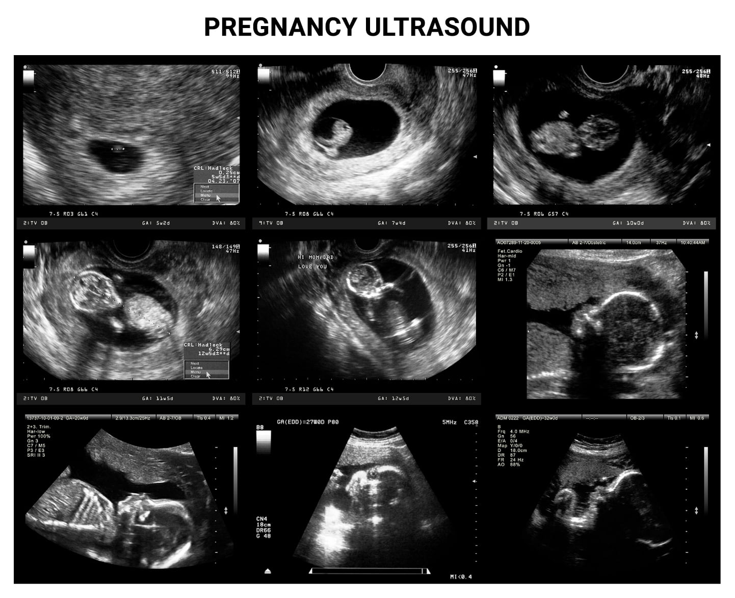 Ultrasounds During Pregnancy What You Need To Know Century Medical 