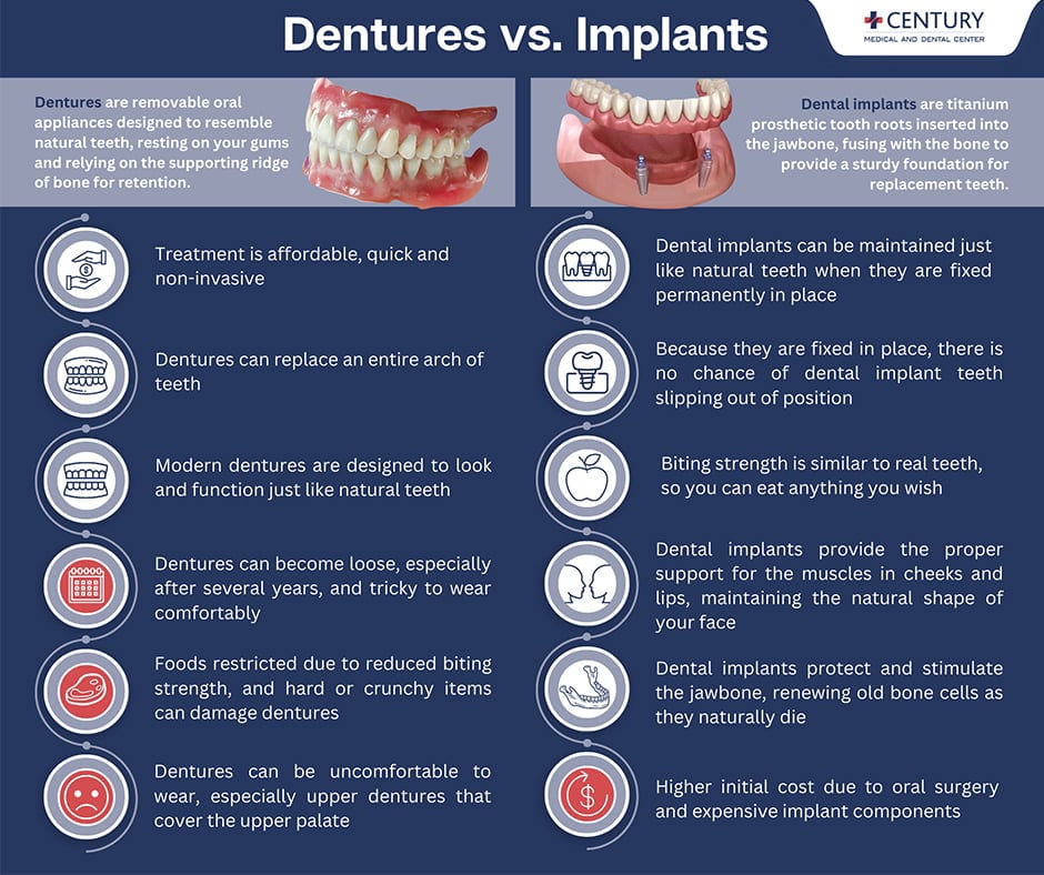 Dental Implants